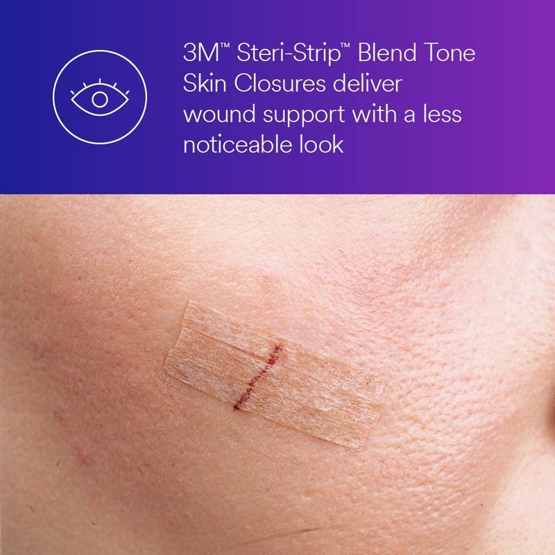 STERI-STRIP 3Mâ„¢ Steri-Stripâ„¢ Blend Tone Skin Closures, B1557, Tan, 1/2 in x 4 in (12mm x 100mm), 50 Bag/Carton, 4 Carton/Case - Image 3